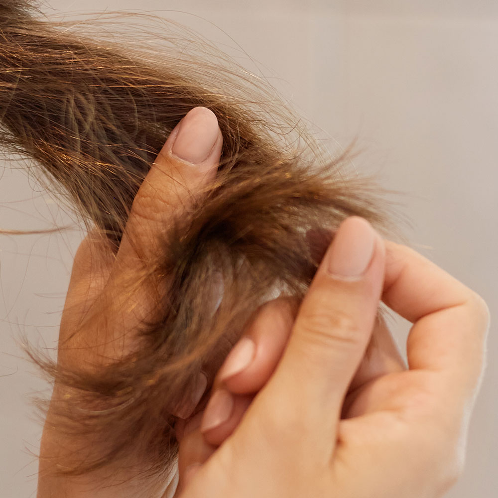 elementos raiz: tratamento ideal para combater a queda de&nbsp;cabelo